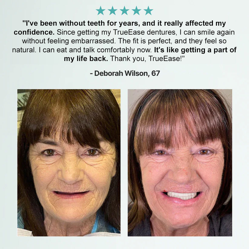 🦷NESLEMY™🦷 𝗔𝗱𝘃𝗮𝗻𝗰𝗲𝗱 𝗖𝘂𝘀𝘁𝗼𝗺𝗶𝘇𝗲𝗱 𝗙𝘂𝗹𝗹 𝗗𝗲𝗻𝘁𝘂𝗿𝗲 𝗦𝗲𝘁(✅Clinically backed comfort-fit dentures — Trusted by 8,000+ USA users for all-day comfort.)